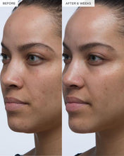 Load image into Gallery viewer, Pineapple-C Bright Serum
